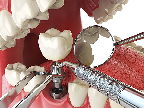 Best Emergency Treatment for Oral Infections in Boonsboro, MD